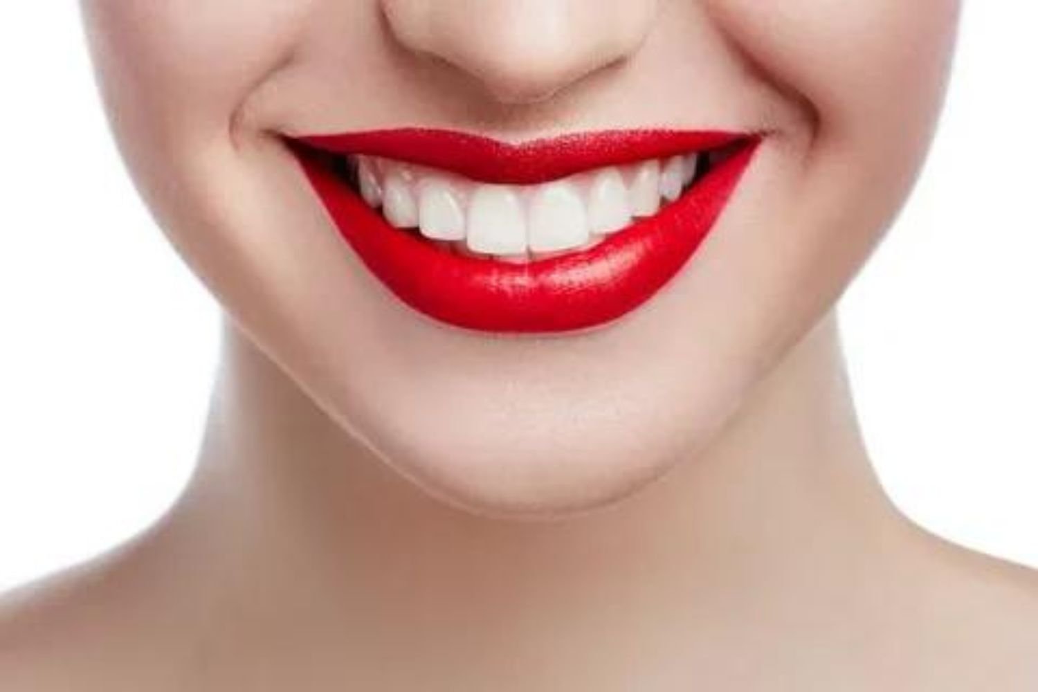 Dental Services- Smile Makeover